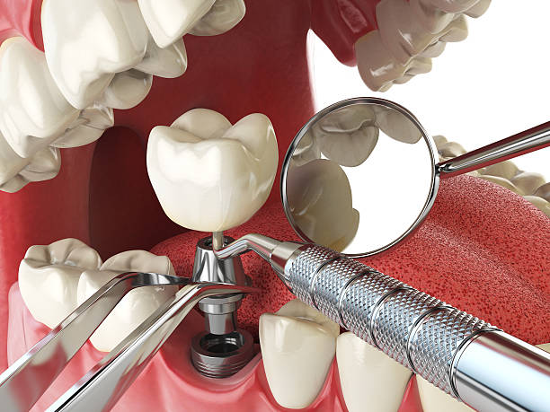 Best Emergency Treatment for Oral Infections in Osceola, AR